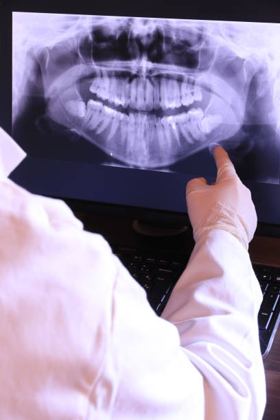 Best Emergency Wisdom Tooth Extraction in Kingsville, MD